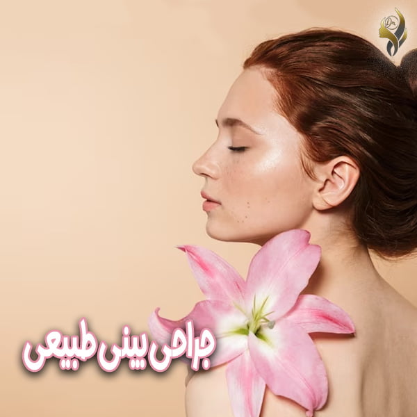 جراحی بینی طبیعی - دکتر علی عقیلی