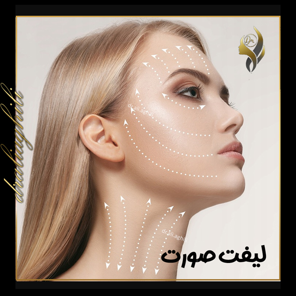 لیفت صورت - دکتر علی عقیلی