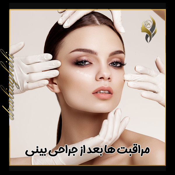 مراقبت های بعد از جراحی بینی - دکتر علی عقیلی