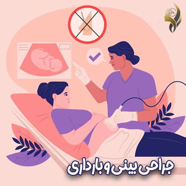 جراحی بینی و بارداری-دکتر علی عقیلی
