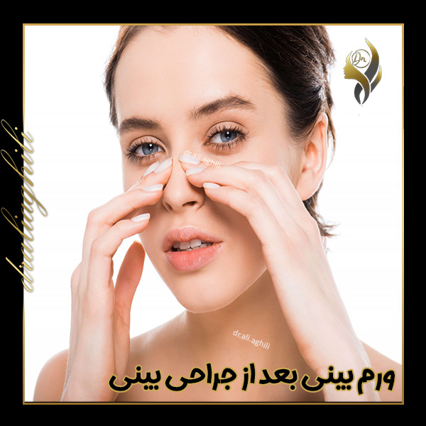 ورم بعد از جراحی بینی ورم بینی بعد از جراحی بینی - https://draliaghili.com/