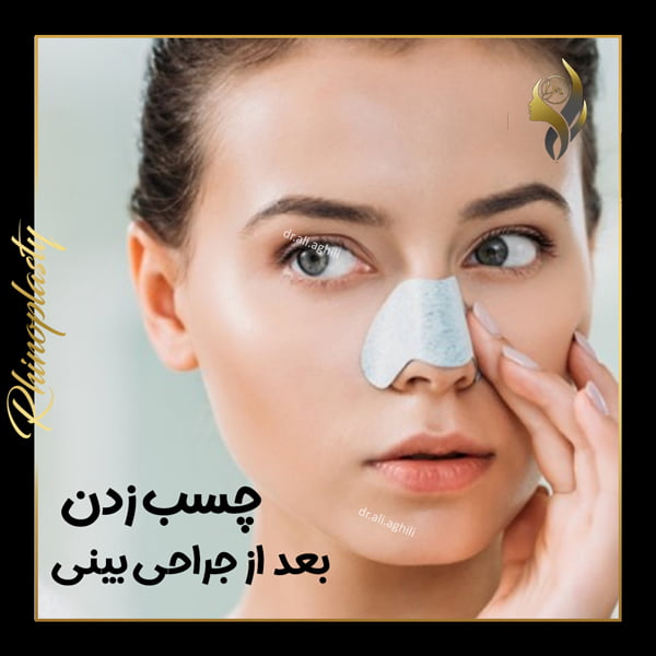 چسب زدن بعد از جراحی بینی - دکتر علی عقیلی در تهران