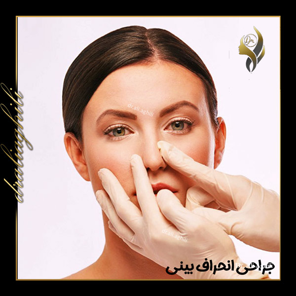 جراحی انحراف بینی