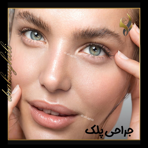 جراحی پلک - دکتر علی عقیلی در تهران