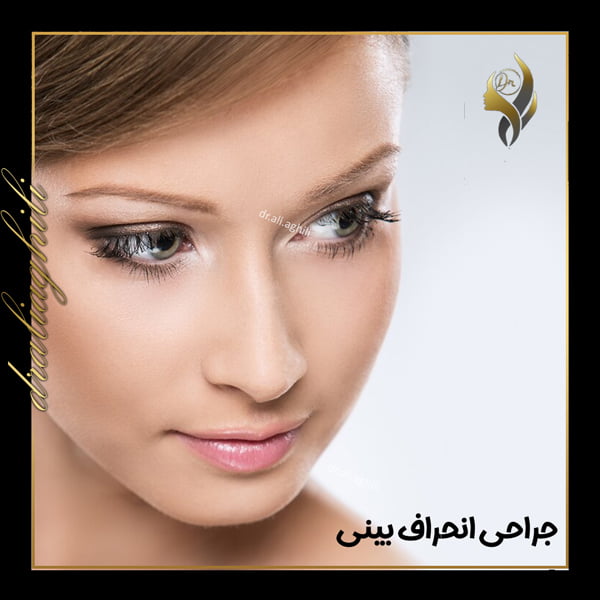 جراحی انحراف بینی - دکتر علی عقیلی