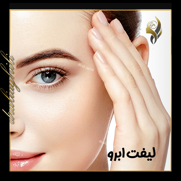 لیفت ابرو - دکتر علی عقیلی