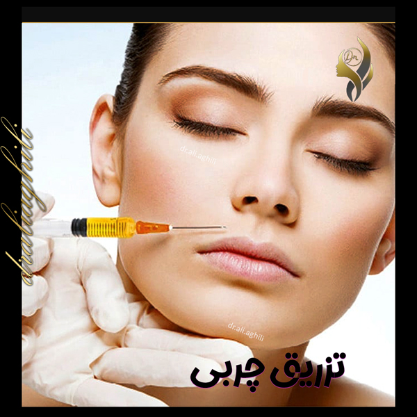 تزریق چربی - دکتر علی عقیلی