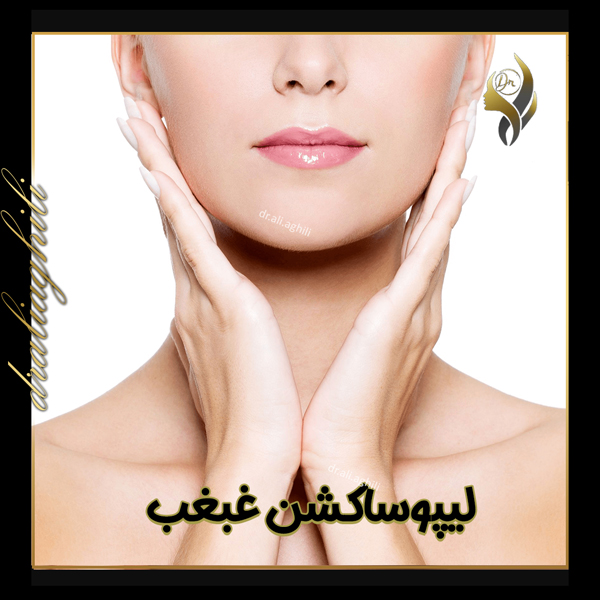 لیپوساکشن غبغب - دکتر علی عقیلی