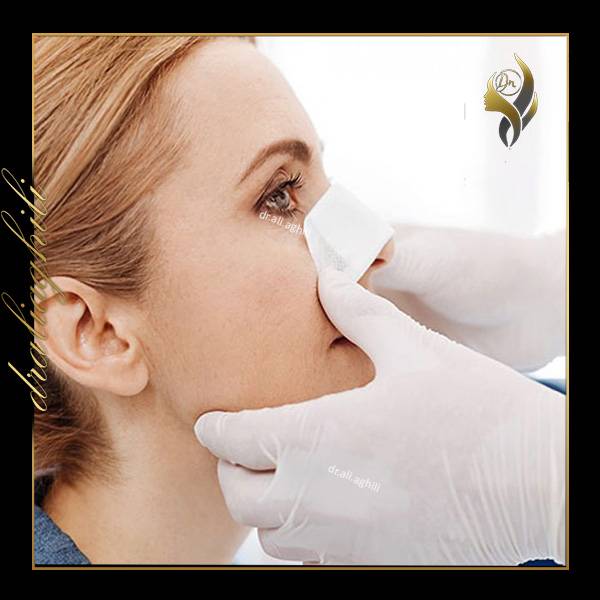 اسپلینت بینی - https://draliaghili.com/