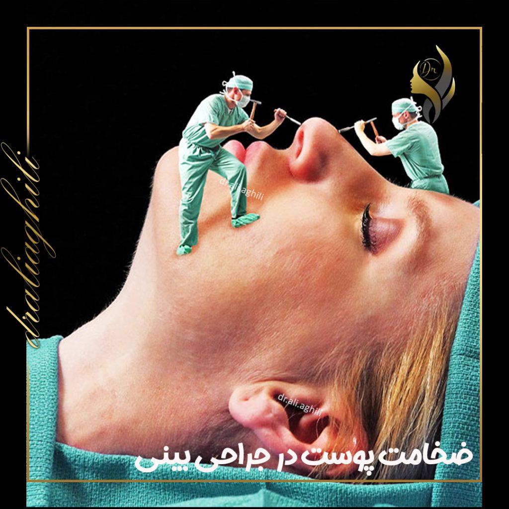 تاثیر ضخامت پوست بر جراحی زیبایی بینی تاثیر ضخامت پوست بر جراحی زیبایی بینی