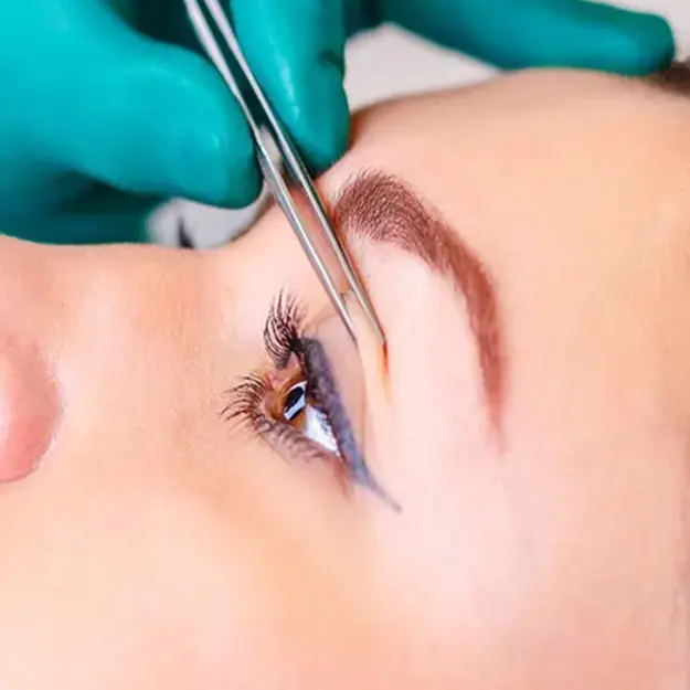 جراحی پلک (بلفاروپلاستی)