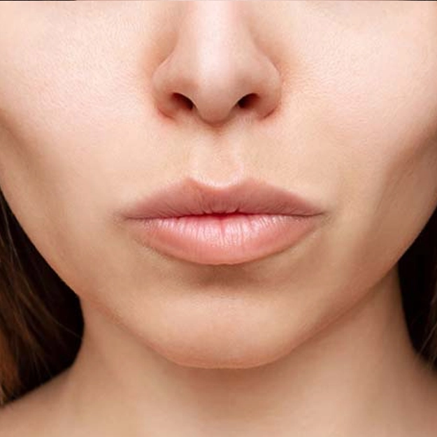 برداشتن چربی (بوکال فت)