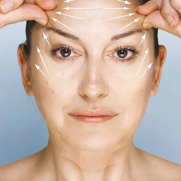 لیفت شقیقه​