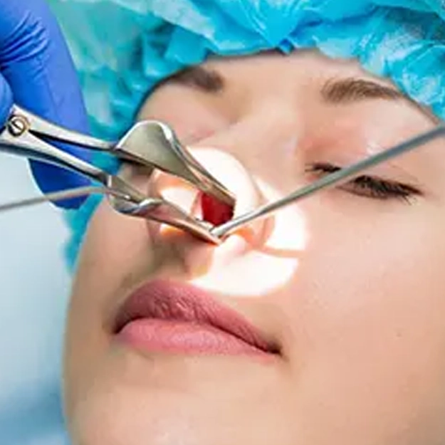 جراحی آندوسکوپی سینوس (درمان پولیپ بینی و سینوزیت مزمن)