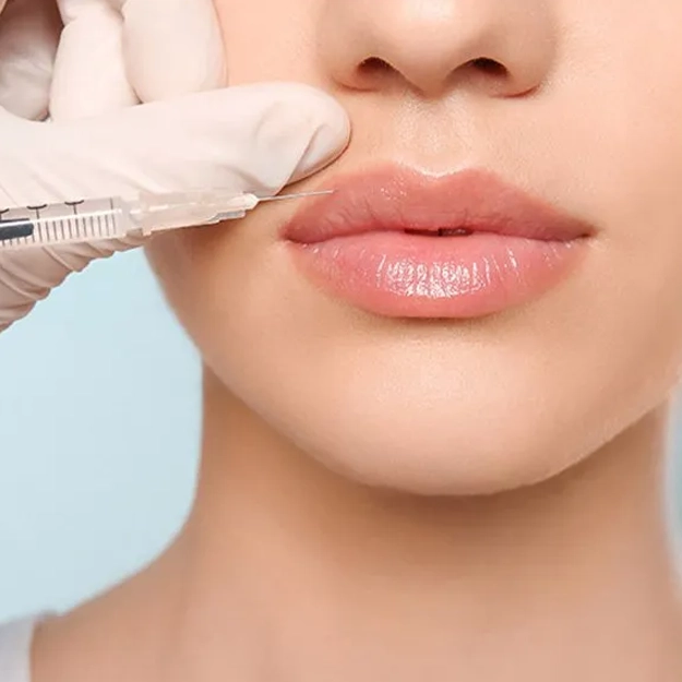 تزریق ژل (فیلر)