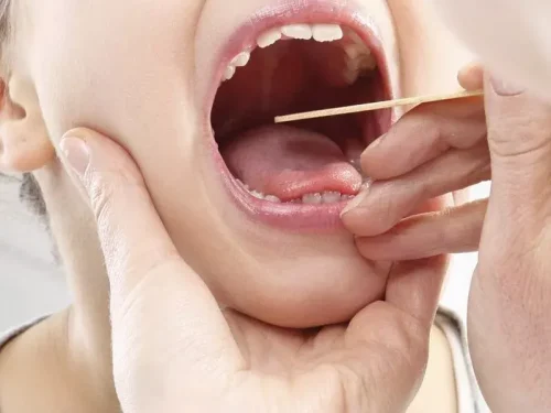 جراحی لوزه جراحی لوزه