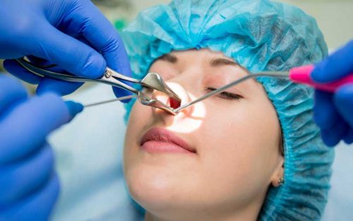 جراحی آندوسکوپی سینوس