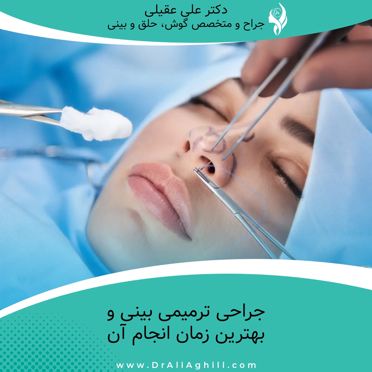 جراحی ترمیمی بینی و بهترین زمان انجام آن