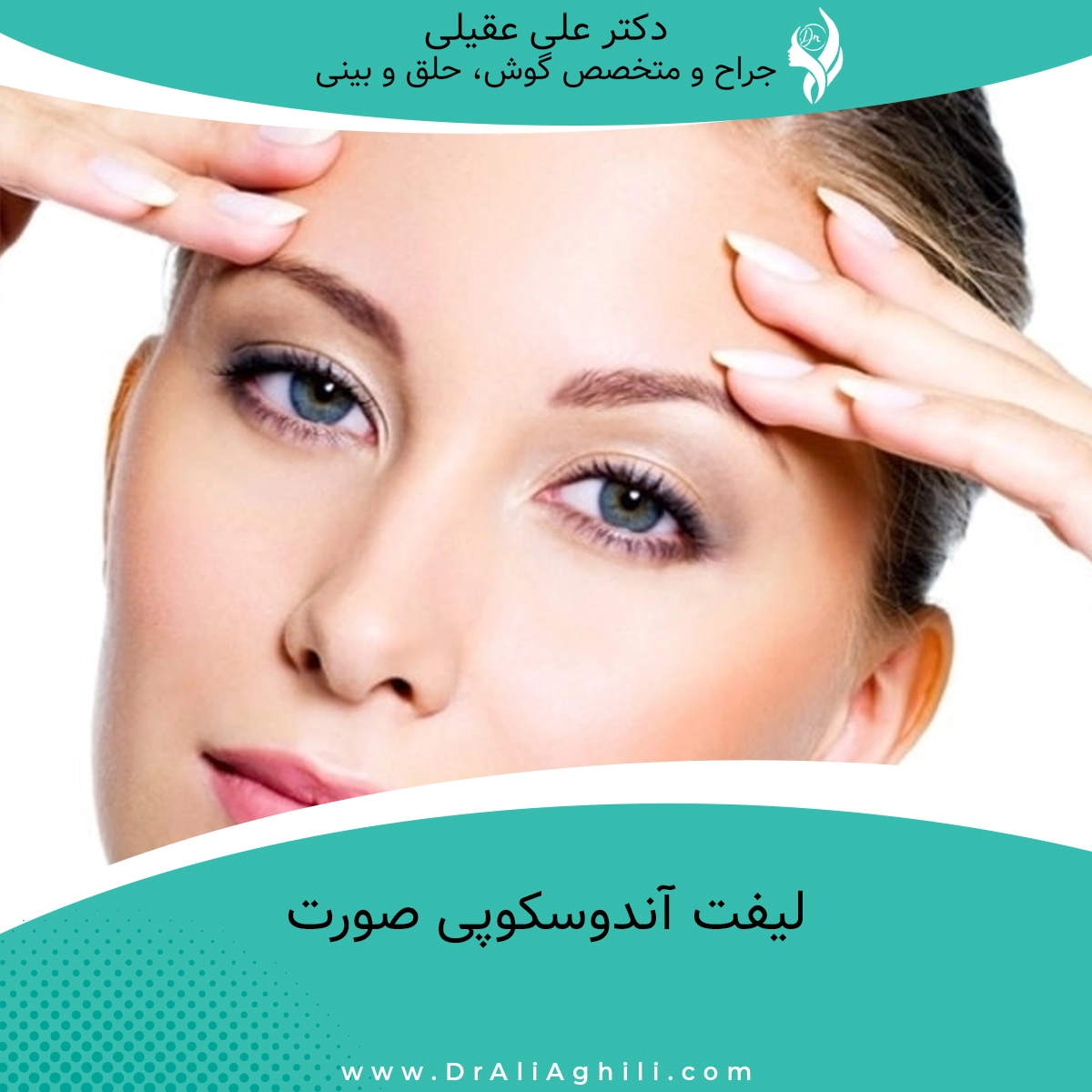 لیفت آندوسکوپی صورت