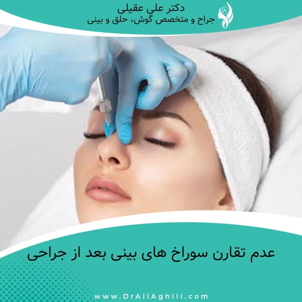 عدم تقارن سوراخ های بینی بعد از جراحی