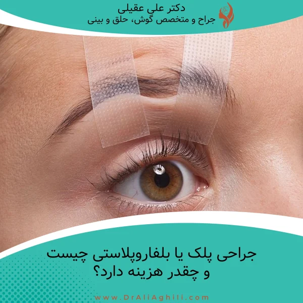جراحی پلک (بلفاروپلاستی)