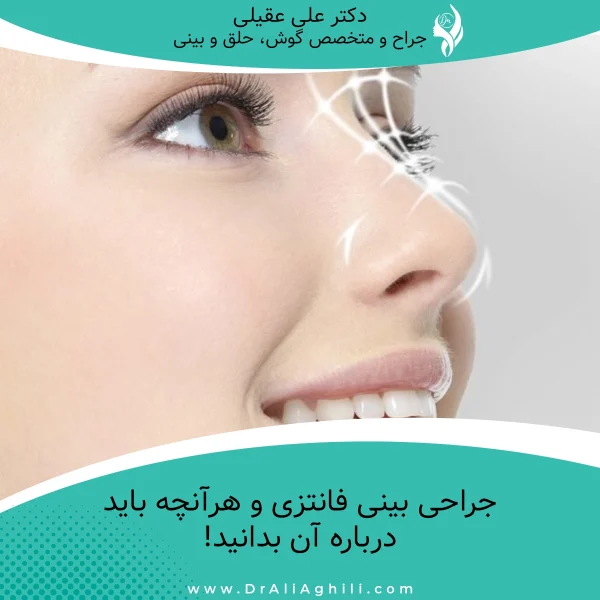 جراحی بینی فانتزی و هرآنچه باید درباره آن بدانید!