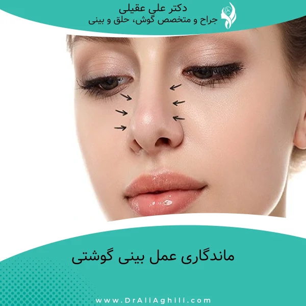 جراحی بینی گوشتی | ماندگاری عمل بینی گوشتی | عمل بینی گوشتی