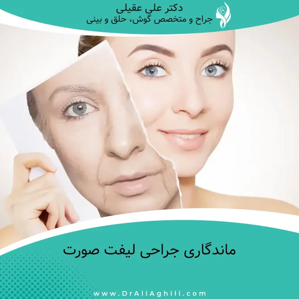 ماندگاری جراحی لیفت صورت