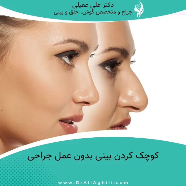 کوچک کردن بینی بدون عمل جراحی