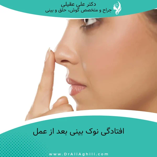 افتادگی نوک بینی بعد از عمل
